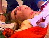 Columbine victim Kacey Ruegsegger, injured by gunfire